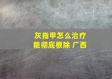 灰指甲怎么治疗能彻底根除 广西